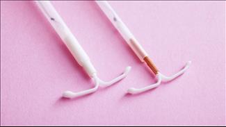 התקן מונע הריון? 5 יתרונות וחסרונות של אמצעי מניעה קבועים