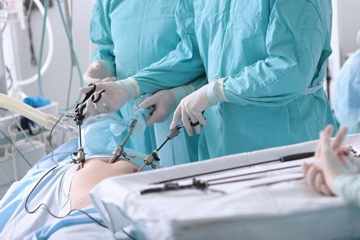 רופאות עם כלי ניתוח מבצעות ניתוח כריתת מעי גס בשיטה לפרוסקופית
